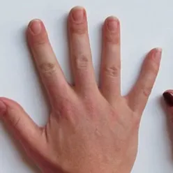 A group of hands with black nails